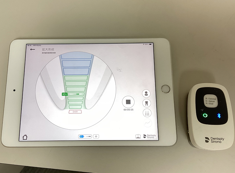 根管長測定器(エンドメーター)その2